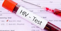 Edukasi HIV AIDS kepada remaja menjadi fokus penting dalam mencegah penyebaran di Kota Bogor. (Sumber: Pinterest)