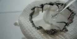 Ilustrasi dampak terkena air keras. (Sumber: Kaskus)