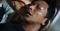 Riko (23), pengemudi ojek alami kehilangan penglihatan sementara usai jadi korban penipuan dan penganiayaan oleh penumpangnya di wilayah Cikarang Utara, Kabupaten Bekasi. (Sumber: Istimewa)