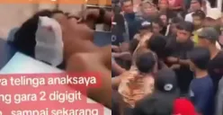 Pria di Banyuwangi digigit pemain jaranan yang kesurupan hingga telinganya putus. (Sumber: Tangkap Layar Instagram/@funnelmedia)