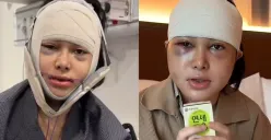 Dilan Janiyar lakukan operasi muka di Korea, respon netizen kecewa. (Sumber: TikTok : @dilanjaniyar.)