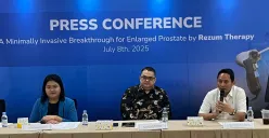 RS Mitra Keluarga Kelapa Gading memperkenalkan teknologi Rezum dari Amerika Serikat, Selasa, 8 Juli 2025. (Sumber: Poskota/Pandi Ramedhan)