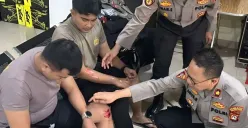Dua anggota Polres Metro Bekasi Kota terluka berupaya membubarkan tawuran remaja di kawasan Kalibaru, Kecamatan Medan Satria, Kota Bekasi, Kamis, 10 Juli 2025. (Sumber: Dok. Polres Metro Bekasi Kota)