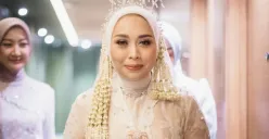 Sosok Putri Karlina, Waki Bupati Garut yang kini menjadi menantu Gubernur Jawa Barat Dedi Mulyadi. (Sumber: Instagram/@putri.karlina14)