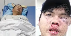 Kondisi para korban pengeroyokan yang diduga dilakukan oknum aparat TNI di Depok. (Sumber: Istimewa)