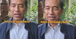 Apa Itu Sindrom Steven Johnson atau SJS, Penyakit Kulit yang Diduga Diidap Jokowi? Intip di Sini (Sumber: TikTok/negeriku_62)