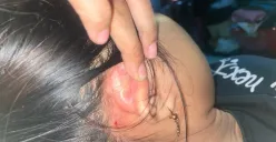 HK mengalami luka di beberapa bagian tubuhnya yang disebabkan oleh IAP. Ia tidak terima jika ditetapkan sebagai tersangka dan mengaku tak kuat membayar uang damai. (Sumber: Poskota/Nurpini Aulia Rapika)