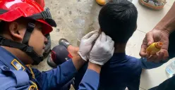 Petugas mengevakuasi telinga remaja asal Pakansari, Cibinong, Kabupaten Bogor, dari kail pancing, Selasa, 4 November 2025. (Sumber: Dok. Damkar Kabupaten Bogor)