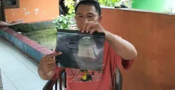 Ayah siswa SMKN 1 Cikarang Barat, Kabupaten Bekasi, menunjukkan hasil rontegn tulang rahang korban perundungan. (Sumber: Dok. Istimewa)