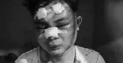 Potret pelaku curanmor di Bogor berinisial EG, babak belur usai ditangkap warga. (Sumber: Polsek Cigudeg)