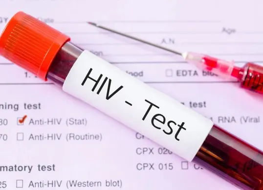 Edukasi HIV AIDS kepada remaja menjadi fokus penting dalam mencegah penyebaran di Kota Bogor. (Sumber: Pinterest)