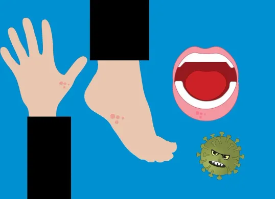 Ilustrasi campak / penyakit menular / virus. (Sumber: Pixabay | Foto: Mohamed_hassan)