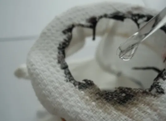 Ilustrasi dampak terkena air keras. (Sumber: Kaskus)