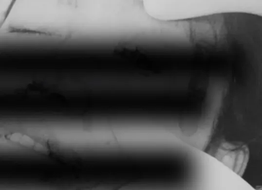 Kondisi wajah korban AA yang babak belur setelah jadi korban KDRT oleh suaminya sendiri. (Sumber: Instagram/@depokhariini)