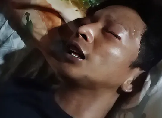 Riko (23), pengemudi ojek alami kehilangan penglihatan sementara usai jadi korban penipuan dan penganiayaan oleh penumpangnya di wilayah Cikarang Utara, Kabupaten Bekasi. (Sumber: Istimewa)