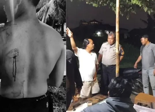 Keadaan punggung korban terluka bacok senjata tajam sama pelaku begal langsung dicek TKP sama anggota. (Sumber: Dok. Polsek Sukmajaya)