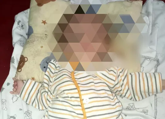 Bayi yang diduga alami gizi buruk di Kampung Pade, Kecamatan Cipeucang, Pandeglang. (Sumber: Dokumen Warga)