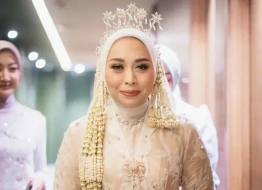 Sosok Putri Karlina, Waki Bupati Garut yang kini menjadi menantu Gubernur Jawa Barat Dedi Mulyadi. (Sumber: Instagram/@putri.karlina14)