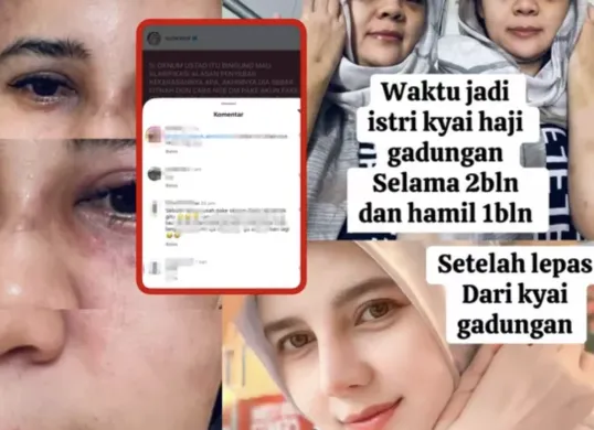 Suila Rohill membagikan foto kondisi lebam usai dugaan kekerasan, memicu simpati dan kemarahan netizen. Nama Ustadz Zaky Mubarok ikut terseret sebagai mantan suami dan terduga pelaku. (Sumber: Instagram/@suilarohill)