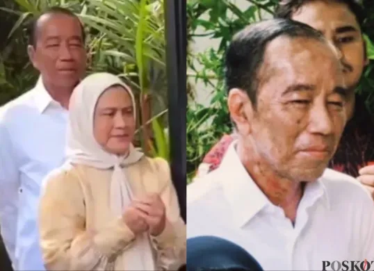 Ulang Tahun ke-64, Wajah Jokowi Makin Memprihatinkan dan Bikin Khawatir (Sumber: X/@DokterTifa dan @CapresCopr53344)