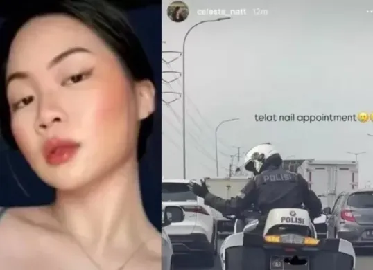 Potret Celeste Anastasia yang viral karena pakai patwal untuk kejar jadwal nail art. (Sumber: Istimewa)