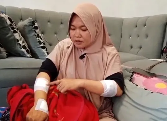 Solihat, guru SD di Tambun Selatan, Kabupaten Bekasi, menunjukkan luka yang dideritanya akibat sabetan senjata tajam pelaku begal. (Sumber: Istimewa)