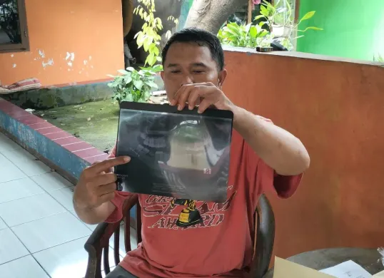 Ayah siswa SMKN 1 Cikarang Barat, Kabupaten Bekasi, menunjukkan hasil rontegn tulang rahang korban perundungan. (Sumber: Dok. Istimewa)