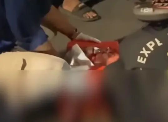 Kecelakaan melibatkan motor dan mobil di Flyover Slipi, Palmerah, Jakarta Barat pada Rabu, 25 Februari 2026 malam. (Sumber: Istimewa)