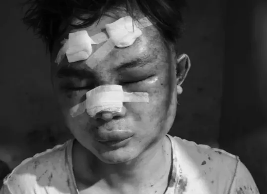 Potret pelaku curanmor di Bogor berinisial EG, babak belur usai ditangkap warga. (Sumber: Polsek Cigudeg)