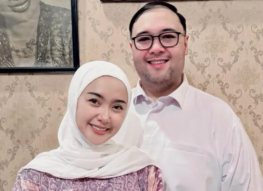 Cita Rahayu alias Cita Citata dikabarkan telah mengajukan gugatan cerai terhadap suaminya, Didi Mahardika. (Sumber: Instagram/@cita_rahayu)