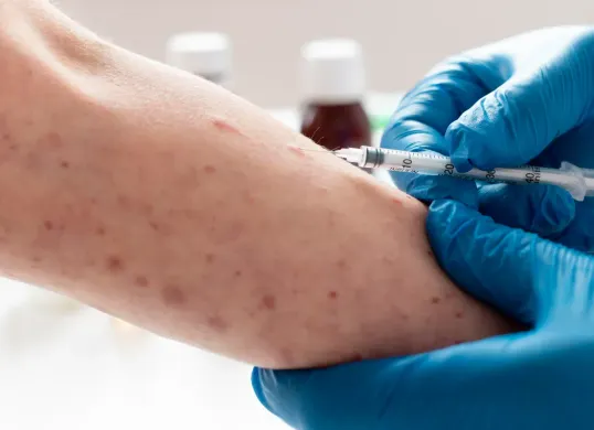 Ilustrasi, Kemenkes siapkan 9,5 juta dosis vaksin, antisipasi lonjakan kasus campak-rubella. (Sumber: freepik)