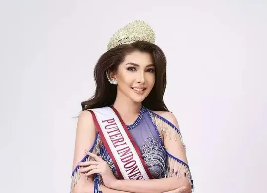 Eks Finalis Puteri Indonesia Riau 2024 Jeni Rahmadial Fitri yang terjerat kasus malapraktik (Sumber: Instagram/@officialputeriindonesia)