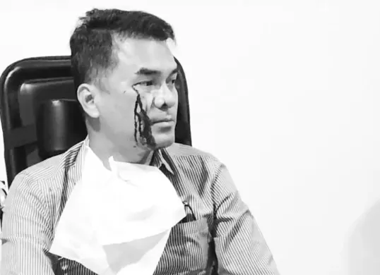 Ronald Aristone Sinaga atau yang akrab disapa Bro Ron tengah menjadi sorotan usai dirinya menjadi korban dugaan penganiayaan di kawasan Menteng, Jakarta Pusat. (Sumber: Instagram/@brorondm)