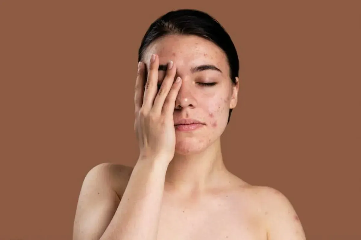Simak panduan lengkap merawat kulit wajah sensitif agar tetap sehat dan bebas iritasi. (Sumber: Pinterest/sahrul ddv)