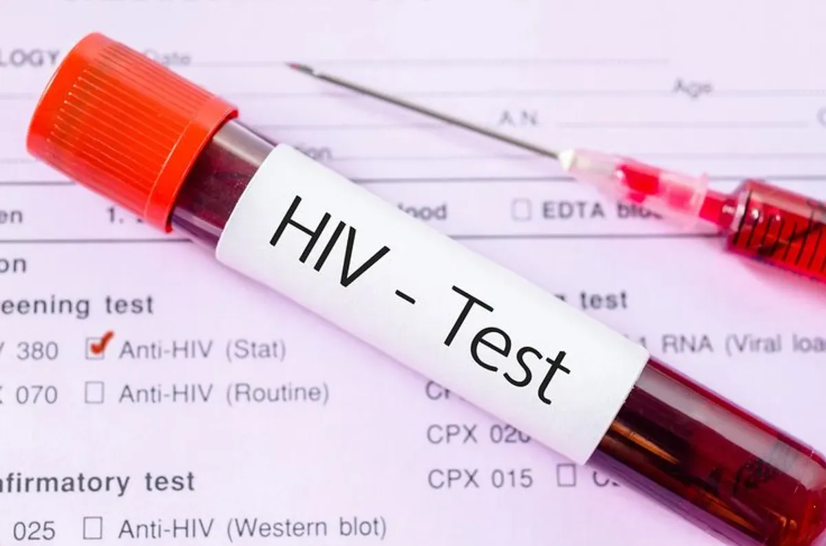 Edukasi HIV AIDS kepada remaja menjadi fokus penting dalam mencegah penyebaran di Kota Bogor. (Sumber: Pinterest)