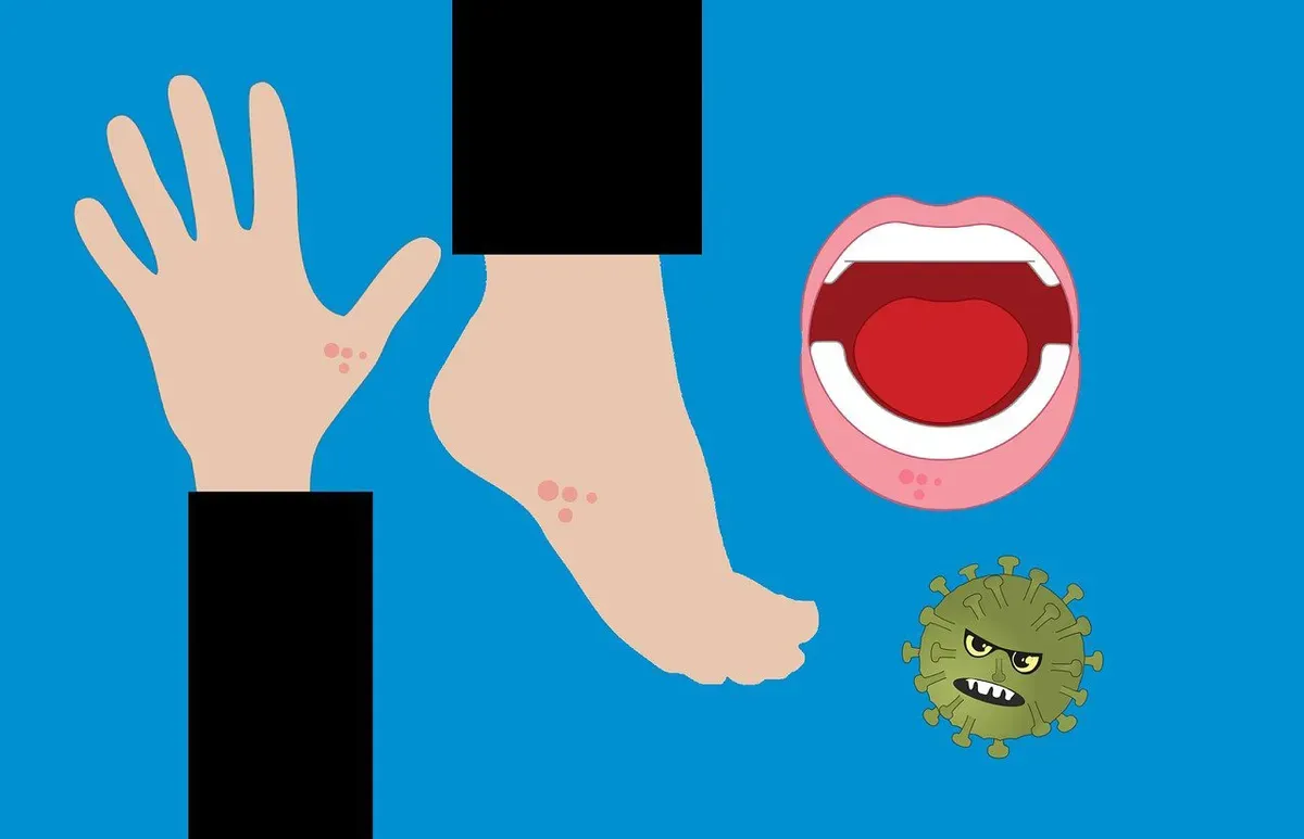 Ilustrasi campak / penyakit menular / virus. (Sumber: Pixabay | Foto: Mohamed_hassan)