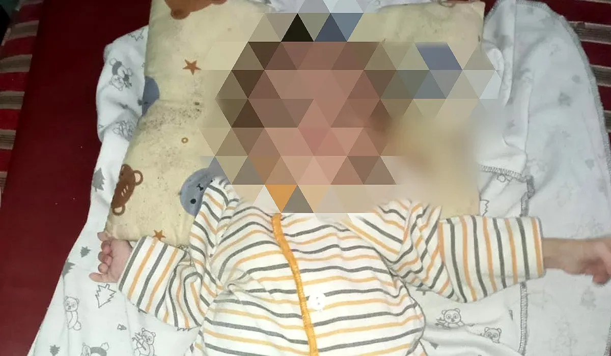 Bayi yang diduga alami gizi buruk di Kampung Pade, Kecamatan Cipeucang, Pandeglang. (Sumber: Dokumen Warga)