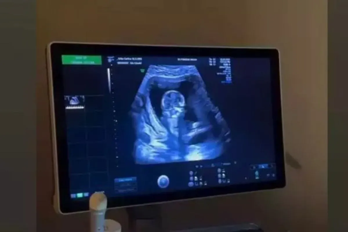 Erika Carlina pastikan kehamilannya bukan settingan, ungkap bukti USG. (Sumber: Instagram)