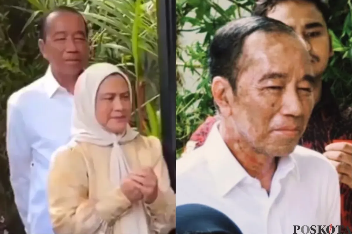 Ulang Tahun ke-64, Wajah Jokowi Makin Memprihatinkan dan Bikin Khawatir (Sumber: X/@DokterTifa dan @CapresCopr53344)