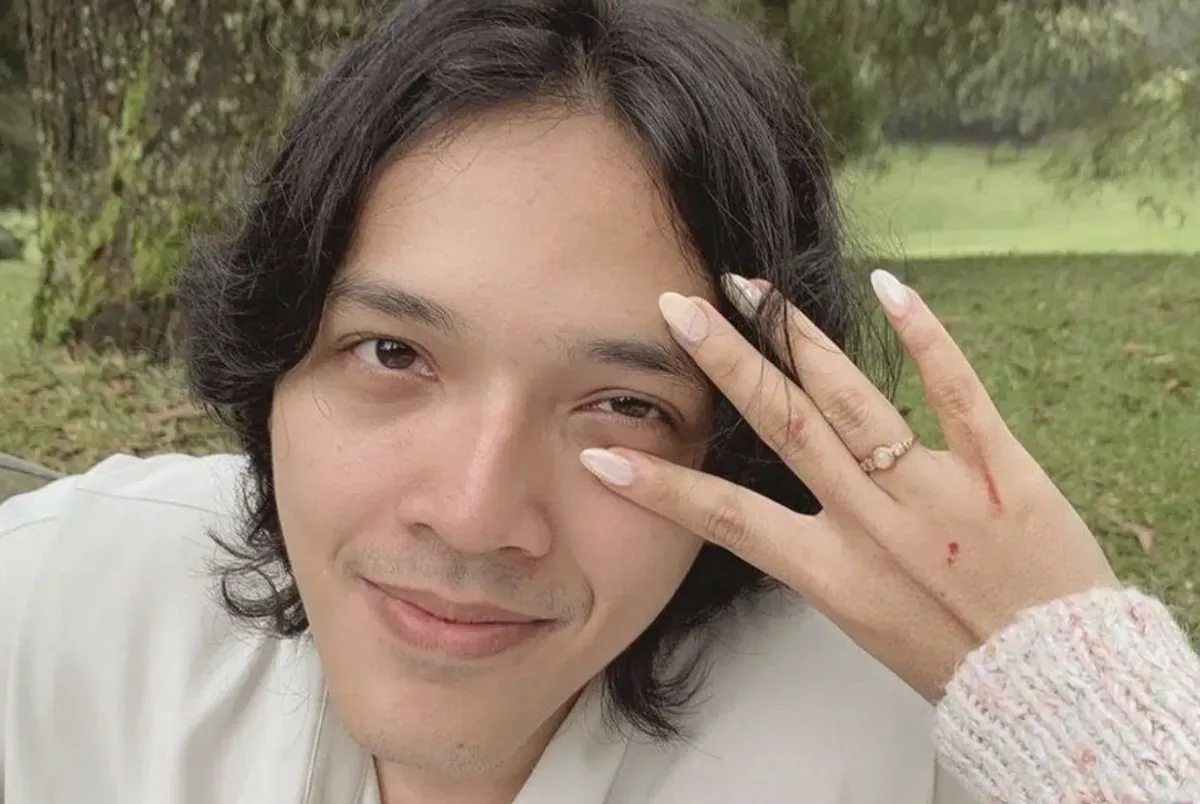 Terungkap! Profesi Faishal Tanjung, Calon Suami Nadin Amizah yang Disebut Adik Sheila Dara Aisha (Sumber: Instagram/Faisal Tanjung)