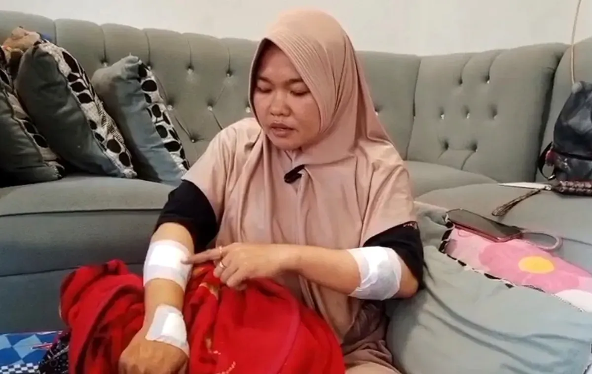 Solihat, guru SD di Tambun Selatan, Kabupaten Bekasi, menunjukkan luka yang dideritanya akibat sabetan senjata tajam pelaku begal. (Sumber: Istimewa)