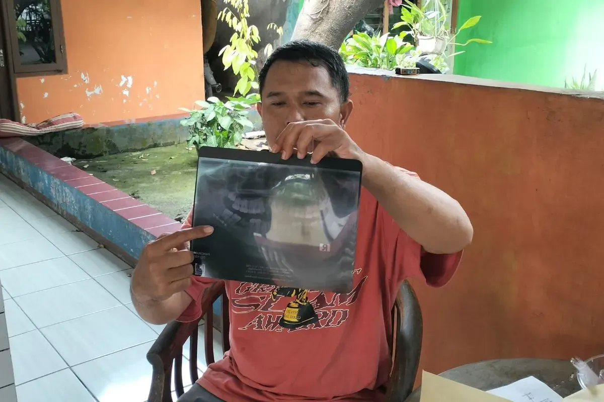 Ayah siswa SMKN 1 Cikarang Barat, Kabupaten Bekasi, menunjukkan hasil rontegn tulang rahang korban perundungan. (Sumber: Dok. Istimewa)