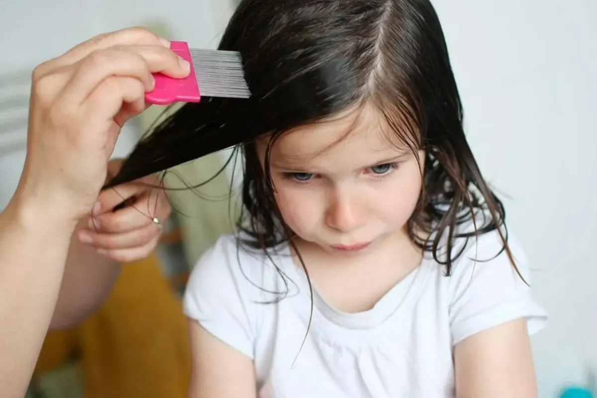 Coba cara membasmi kutu rambut hingga telurnya dengan metode alami. (Sumber: Pinterest/Rustica)
