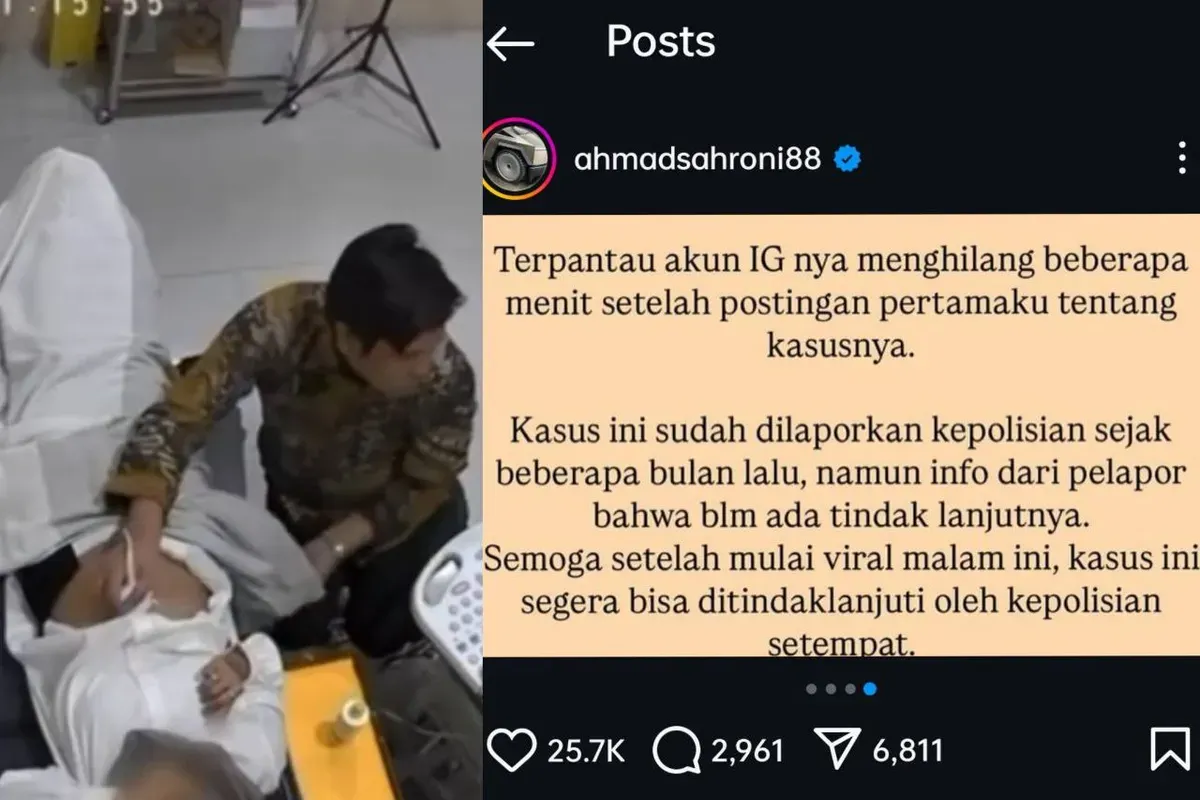 Polres Garut tanggapi dugaan dokter kandungan melakukan pelecehan kepada pasien saat pemeriksaan USG. (Sumber: Instagram/@ahmadsahroni 88)