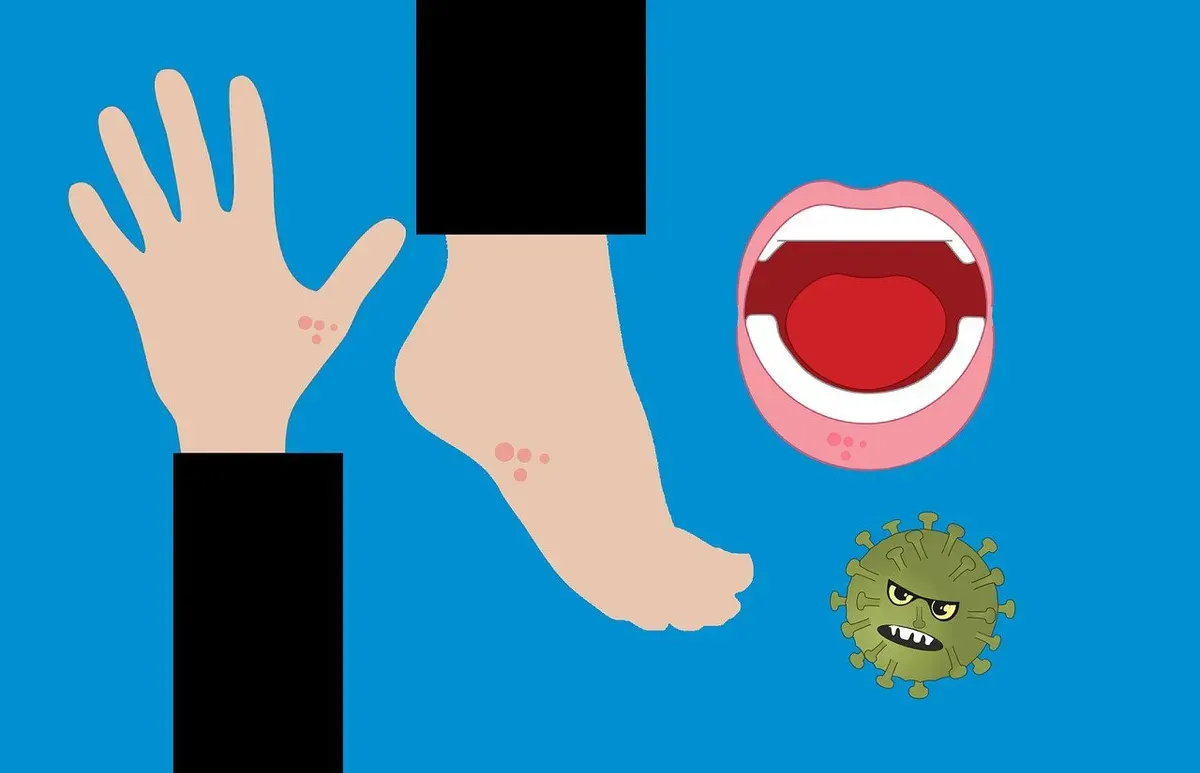 Ilustrasi campak / penyakit menular / virus. (Sumber: Pixabay | Foto: Mohamed_hassan)