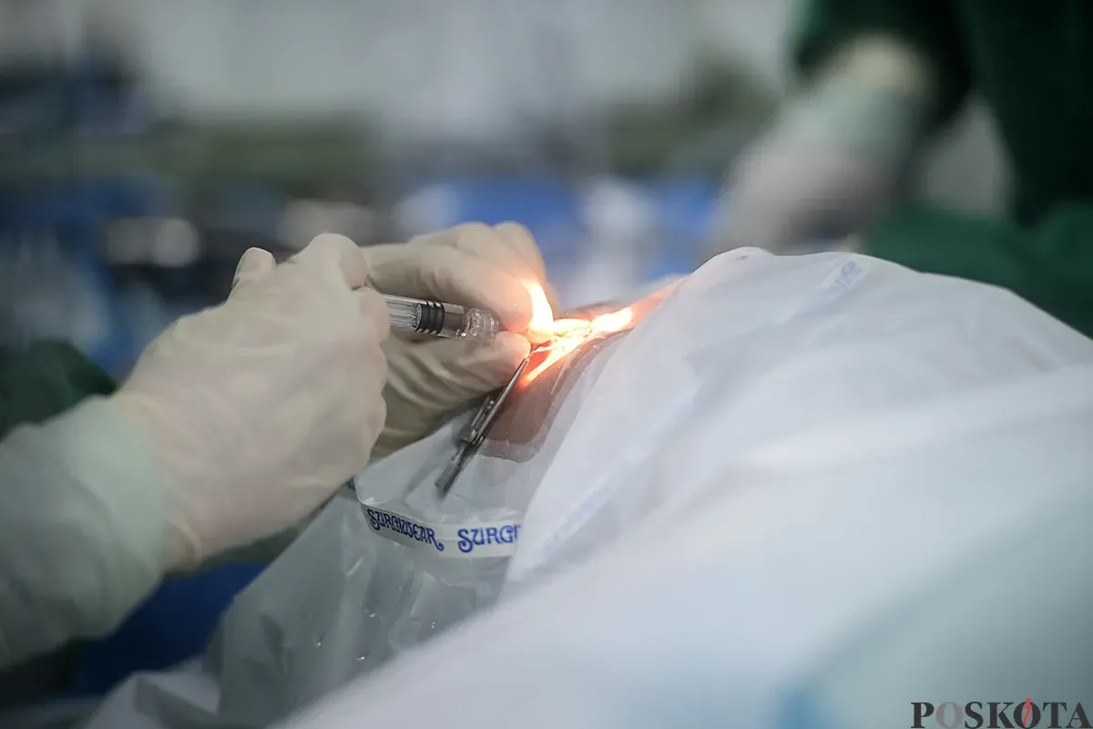 Tim dokter melakukan operasi pengangkatan katarak kepada para pasien yang sudah terdaftar sebelumnya di RSUD Tamansari, Jakarta, Sabtu, 25 Januari 2025. (Sumber: Poskota/Bilal Nugraha Ginanjar)