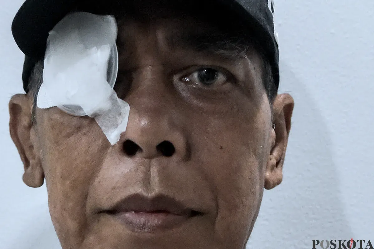 Tim dokter melakukan operasi pengangkatan katarak kepada para pasien yang sudah terdaftar sebelumnya di RSUD Tamansari, Jakarta, Sabtu, 25 Januari 2025. (Sumber: Poskota/Bilal Nugraha Ginanjar)