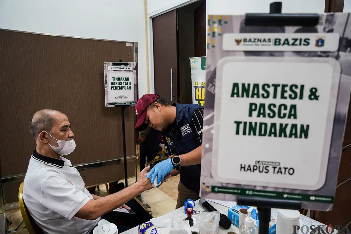 Petugas menghapus tato peserta menggunakan laser di Balai Kota DKI Jakarta, Senin, 10 Maret 2025. (Sumber: Poskota/Bilal Nugraha Ginanjar)