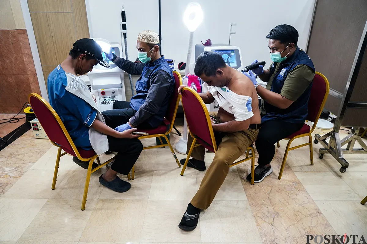 Petugas menghapus tato peserta menggunakan laser di Balai Kota DKI Jakarta, Senin, 10 Maret 2025. (Sumber: Poskota/Bilal Nugraha Ginanjar)