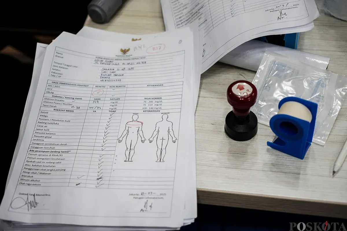 Petugas menghapus tato peserta menggunakan laser di Balai Kota DKI Jakarta, Senin, 10 Maret 2025. (Sumber: Poskota/Bilal Nugraha Ginanjar)
